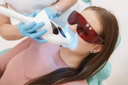 Blanqueamiento Dental con Láser: ¿Es seguro? 13 Clínica Dental en Molina de Segura blanqueamiento de dientes con laser