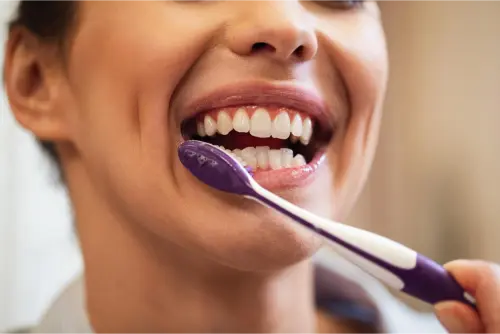 ✅Blanquear las carillas de composite en casa 12 Clínica Dental en Molina de Segura carillas dentales para poner en casa