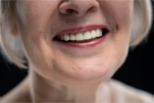 ✅Blanquear las carillas de composite en casa 14 Clínica Dental en Molina de Segura limpiar carillas con bicarbonato
como blanquear la resina de los dientes