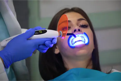 Blanqueamiento Dental con Láser: ¿Es seguro? 14 Clínica Dental en Molina de Segura blanqueamiento dental por laser